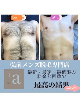 メンズ プラス アルファ(Mens plus a+)/全身脱毛で清潔感UP！モテる！