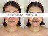 【初回】疲れ顔解消！引上げたるみケア光フェイシャル60分¥4,980