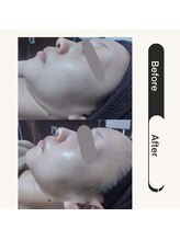 一呼休/フェイシャルエステ