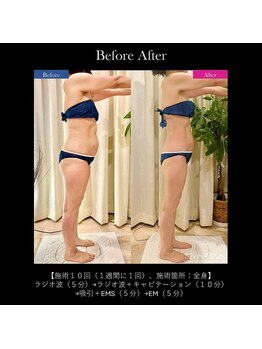 アディクト(Addict)/Before＆After