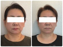 美容整体 ウェリナ 蟹江院/小顔矯正/骨盤矯正/美脚サロン