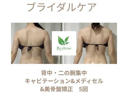 リシャイン(Reshine)の写真