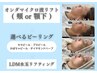 オンダマイクロ波リフト( 顎下or頬 ) 40KJ＋選べるピーリング＋LDM ￥23000