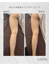 LiNOA./90分全身サイズダウン