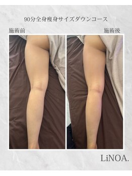 LiNOA./90分全身サイズダウン