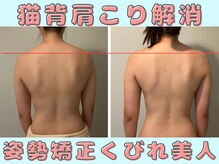 プレフィール(PLEAFEEL)/姿勢矯正