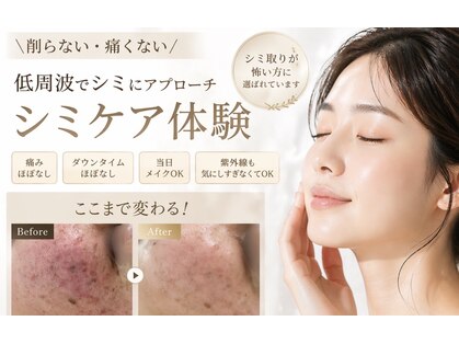 アールエム ボーテ(RM beaute')の写真