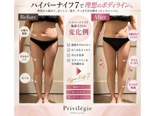 プリヴィエレジェ(privilegie)/ハイパーナイフ7 施術４回