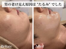 シャルム(Charme)の雰囲気（たるみ・食いしばり・むくみケアまで頭皮からしっかり★）