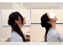 叶'エル 本町 心斎橋院/猫背整体