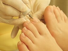 フットケアリストシュウ(footcarelist shu)/施術【一人で切れない爪切り】