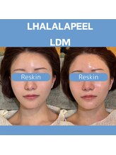 リスキン(Reskin)/《ツヤ》