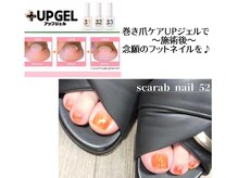 スカラべネイル52 春日部(Scarab Nail 52)/早めの*巻き爪ケア対策*足元美人