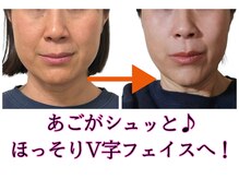 シェノン(CHAINON)