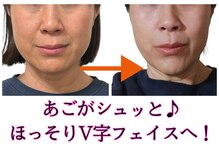 シェノン(CHAINON)