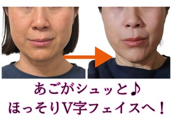 シェノン(CHAINON)