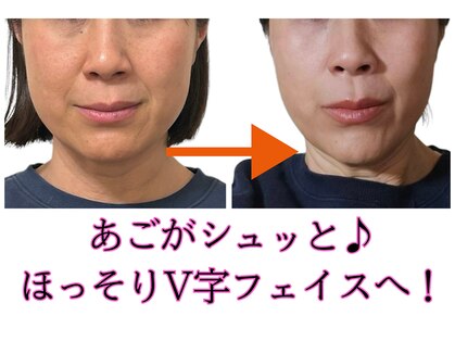 シェノン(CHAINON)の写真