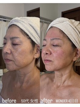 フロル(FLOR)/WONDER face