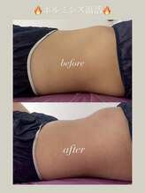 キララ(Kirara)/冬はホルミシス温活♪