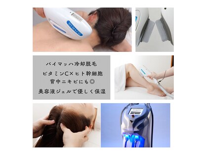 キャナ(CANA)の写真