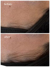 アンドエミニー エン ラボーテ(& EMINY 艶 la beaute)/美肌フェイシャルWax脱毛