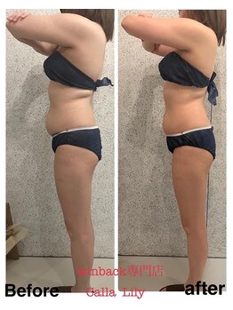 カラーリリー(Calla Lily)/上半身のお悩み（初回）