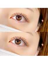 ビューティーホスピタル(Beauty Hospital)/ダークブラウン＆ブラウンmix