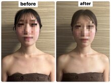 ライズサロン(RiseSALON)/オールハンドリンパマッサージ