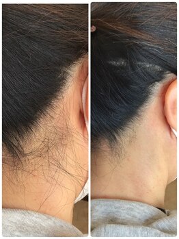 グラナダ 2F(Granada)/