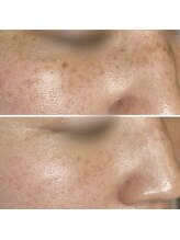 ルーム(room)/プラズマシミケア