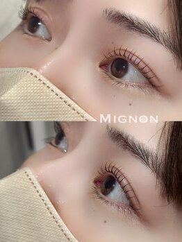 ミニョン(Mignon)/ラッシュリフト/まつげパーマ