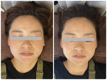 コニワ(528hz)/シンメトリー整顔Before⇔After