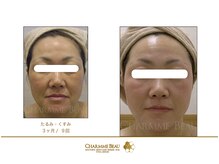 アムレット(Amourette)/サロン品質ホームケアで、ツヤ肌