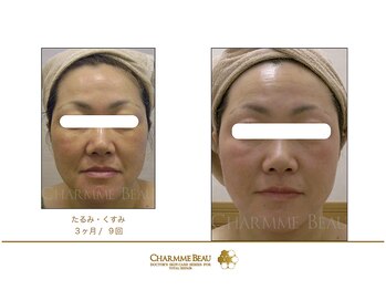 アムレット(Amourette)/サロン品質ホームケアで、ツヤ肌