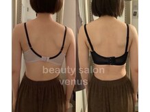 ヴィーナス(Venus)/バストアップで肩甲骨矯正も！