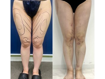 リメイク 広尾(REMAKE)/