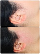 シュガーリングハウス ベル(Bell)/もみあげシュガーリング