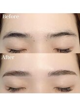 レピア 郡山駅前店/韓国式LEPIA Before&After