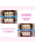 【回数券＊人気NO.1】ホワイトニング8回コース+1回♪44820→33600円