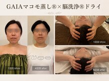 ブルースター(BlueStar)の雰囲気（内側も整いますが、見た目の変化も大きく出ます♪）