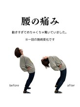 整体院チルアンドママ(CHILL&mama)/腰痛