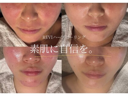 ルミライズ(lumirise)の写真
