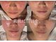 ルミライズ(lumirise)の写真