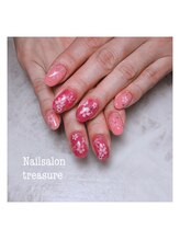 トレジャー(treasure)/