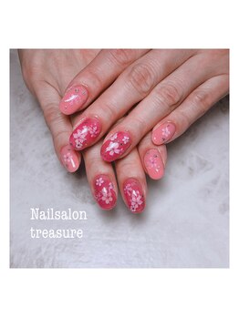 トレジャー(treasure)/