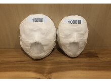 ミピマムマリール(Mipimam Marire)/Before、After