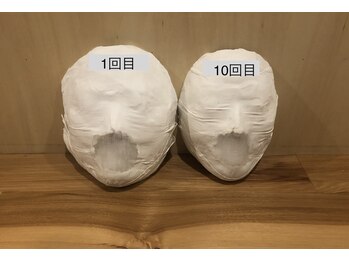 ミピマムマリール(Mipimam Marire)/Before、After