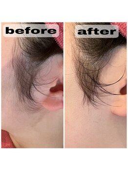 リンク(LiNK)/☆マスクでは隠れない場所☆