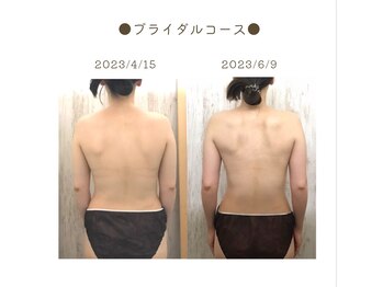 シエルブルー(ciel bleu)/ブライダルコース  before after