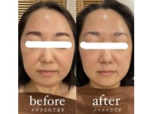 トゥーリ 春日店(tuuli)/ビフォーアフター